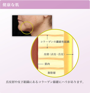 健康な肌　真皮層や皮下組織にあるコラーゲン線維にハリがあります。