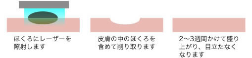 電気分解法